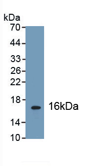 Polyclonal Antibody to Glucagon Like Peptide 1 Receptor (GLP1R)