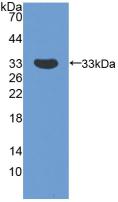 Polyclonal Antibody to Survival Of Motor Neuron 2, Centromeric (SMN2)