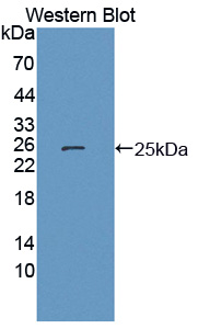 Polyclonal Antibody to Heat Shock Protein Beta 7 (HSPb7)