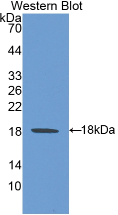 Polyclonal Antibody to Heat Shock 105kDa/110kDa Protein 1 (HSPH1)