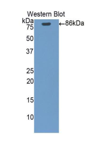 Polyclonal Antibody to Heat Shock Protein 90kDa Alpha B1 (HSP90aB1)