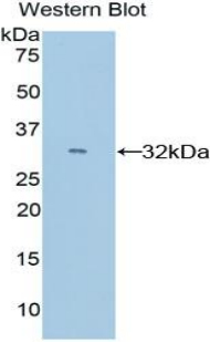 Polyclonal Antibody to Cytochrome P450 26A1 (CYP26A1)