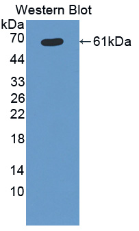 Polyclonal Antibody to Cytochrome P450 11B1 (CYP11B1)