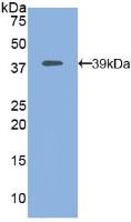 Polyclonal Antibody to Mitogen Activated Protein Kinase Kinase 1 (MAP2K1)