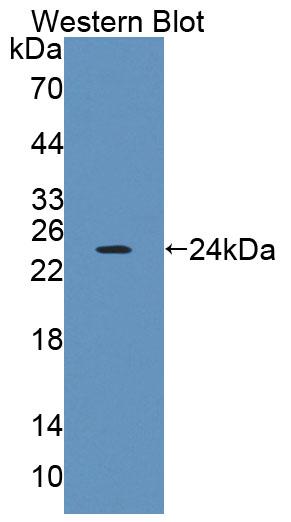 Polyclonal Antibody to Protein Tyrosine Phosphatase Receptor Type A (PTPRA)