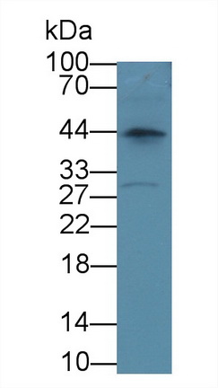 Polyclonal Antibody to Protein Tyrosine Phosphatase Like Protein A (PTPLA)