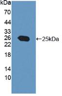 Polyclonal Antibody to Protein Tyrosine Phosphatase Type IVA 3 (PTP4A3)