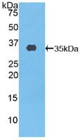 Polyclonal Antibody to ATP Binding Cassette Transporter A3 (ABCA3)