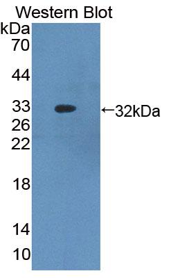 Polyclonal Antibody to ATP Binding Cassette Transporter B8 (ABCB8)