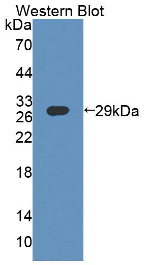 Polyclonal Antibody to ATP Binding Cassette Transporter F1 (ABCF1)