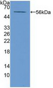 Polyclonal Antibody to ATP Binding Cassette Transporter A13 (ABCA13)