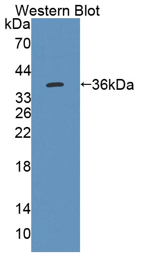 Polyclonal Antibody to Acetyl Coenzyme A Acyltransferase 2 (ACAA2)