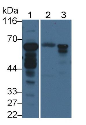 Polyclonal Antibody to Acyl Coenzyme A Synthetase Medium Chain Family, Member 1 (ACSM1)