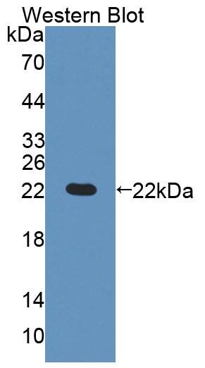 Polyclonal Antibody to Glutaryl Coenzyme A Dehydrogenase (GCDH)