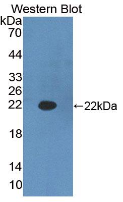 Polyclonal Antibody to Hydroxyacyl Coenzyme A Dehydrogenase (HADH)