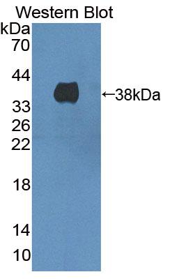 Polyclonal Antibody to 3-Hydroxymethyl-3-Methylglutaryl Coenzyme A Lyase (HMGCL)