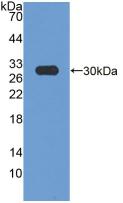 Polyclonal Antibody to 3-Hydroxy-3-Methylglutaryl Coenzyme A Reductase (HMGCR)