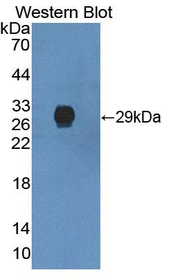 Polyclonal Antibody to Isovaleryl Coenzyme A Dehydrogenase (IVD)