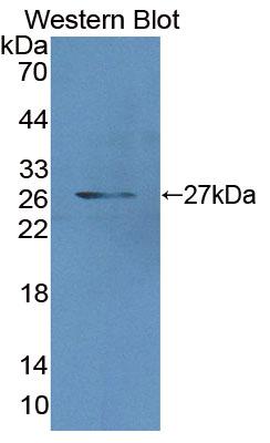 Polyclonal Antibody to Methylcrotonoyl Coenzyme A Carboxylase 2 (MCCC2)