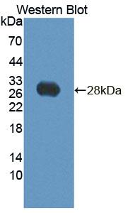 Polyclonal Antibody to Bisphosphoglycerate Mutase (BPGM)