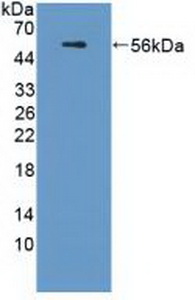 Polyclonal Antibody to Apolipoprotein L (APOL1)