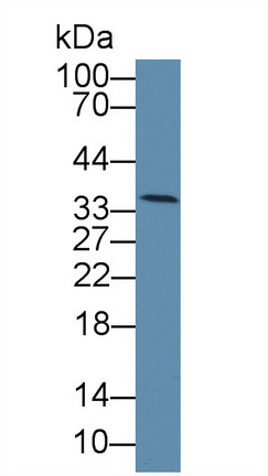 Polyclonal Antibody to Low Density Lipoprotein Receptor Related Protein 11 (LRP11)