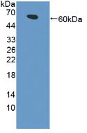 Polyclonal Antibody to Low Density Lipoprotein Receptor Related Protein 4 (LRP4)