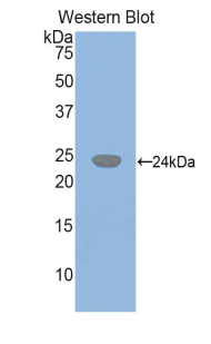 Polyclonal Antibody to Glutathione Synthetase (GSS)