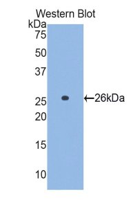 Polyclonal Antibody to Glutamate Cysteine Ligase, Catalytic (GCLC)