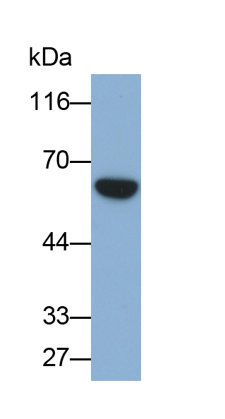 Polyclonal Antibody to Asparagine Synthetase (ASNS)