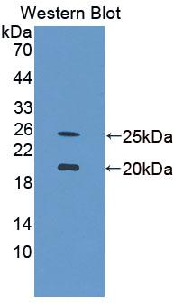 Polyclonal Antibody to Arginine Vasopressin Induced Protein 1 (AVPI1)