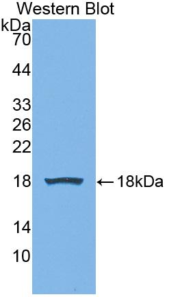 Polyclonal Antibody to Preprovasopressin (VP)