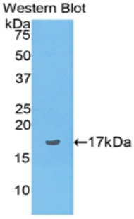 Polyclonal Antibody to Preprovasopressin (VP)