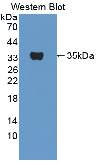 Polyclonal Antibody to Tryptase Beta 2 (TPSb2)