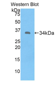 Polyclonal Antibody to Metallothionein 1E (MT1E)