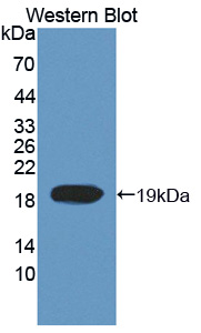 Polyclonal Antibody to Topoisomerase III (TOP3)