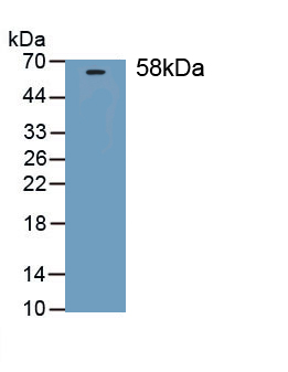 Polyclonal Antibody to Thrombospondin 3 (THBS3)