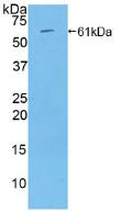 Polyclonal Antibody to Thrombospondin 4 (THBS4)