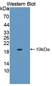 Polyclonal Antibody to Phospholipase A2, Pancreas (pPLA2)