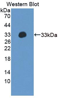 Polyclonal Antibody to Phospholipase C Delta 4 (PLCd4)