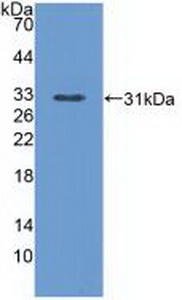 Polyclonal Antibody to Phospholipase C Epsilon 1 (PLCe1)