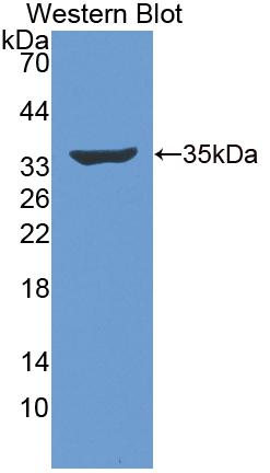 Polyclonal Antibody to Phospholipase C Epsilon 1 (PLCe1)