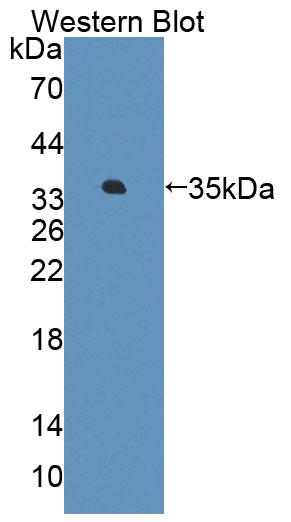 Polyclonal Antibody to Alanine Glyoxylate Aminotransferase 2 (AGXT2)