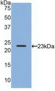 Polyclonal Antibody to Relaxin 2 (RLN2)