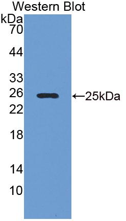 Polyclonal Antibody to Tumor Necrosis Factor Receptor Superfamily, Member 25 (TNFRSF25)