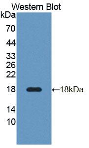 Polyclonal Antibody to Tumor Necrosis Factor Receptor Superfamily, Member 25 (TNFRSF25)