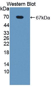 Polyclonal Antibody to Nuclear Receptor Subfamily 1, Group D, Member 2 (NR1D2)