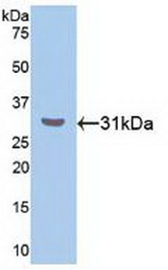 Polyclonal Antibody to RAR Related Orphan Receptor Alpha (RORa)