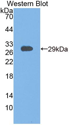 Polyclonal Antibody to Testicular Receptor 4 (TR4)