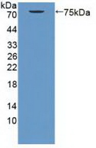 Polyclonal Antibody to Photoreceptor Cell Specific Nuclear Receptor (PNR)